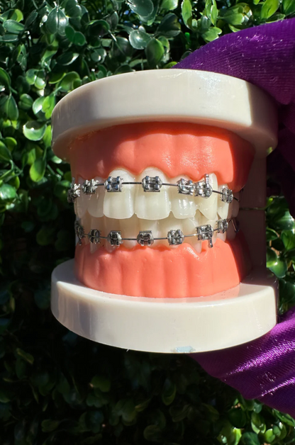 Clip-on Braces